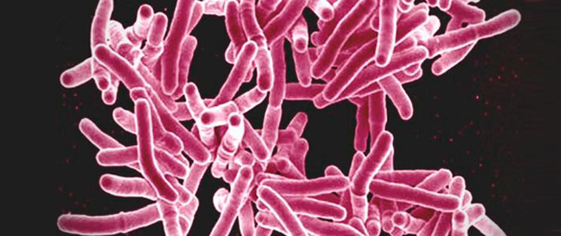 mikroskopowe zdjęcie bakterii gruźlicy