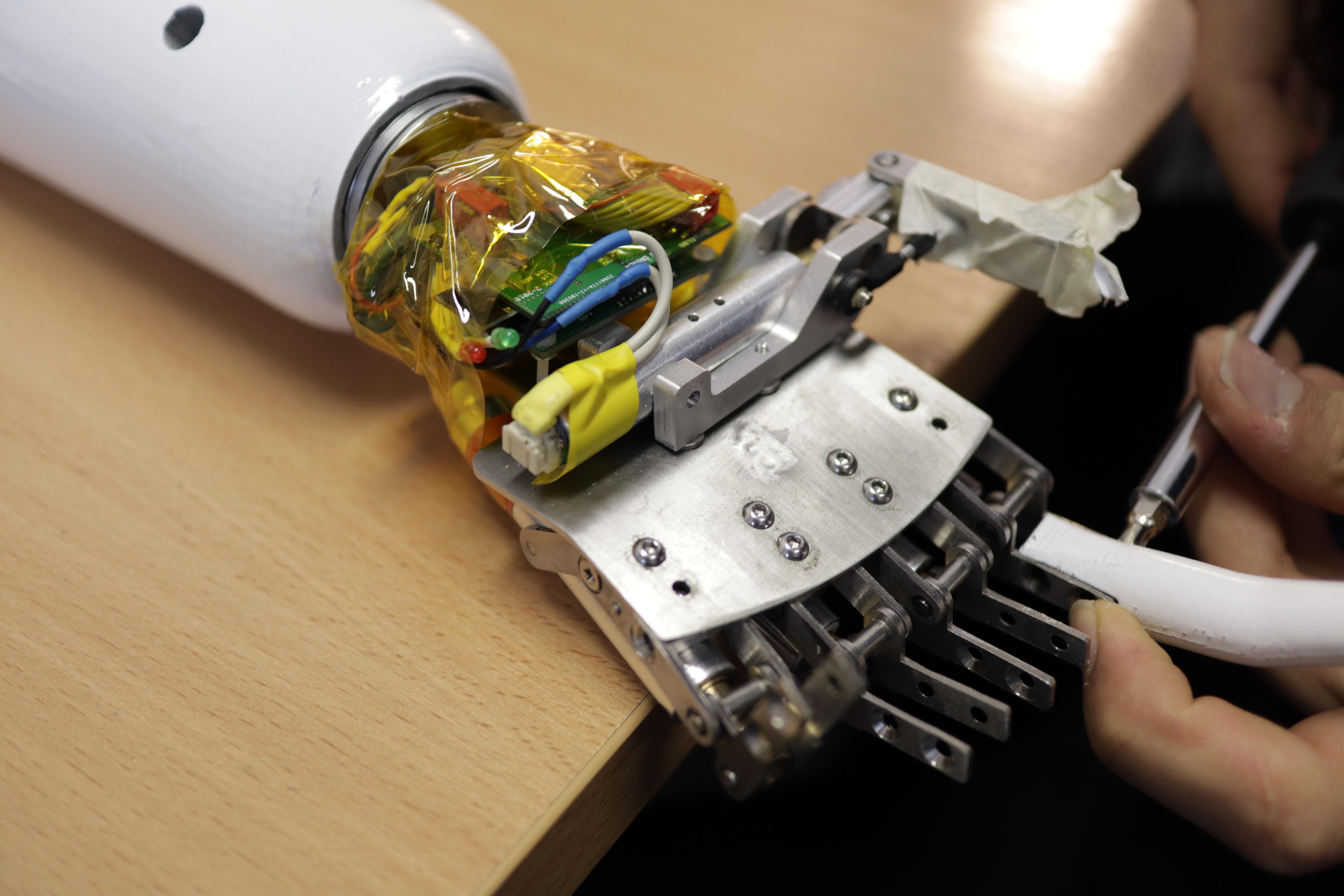 Modularna budowa SuperHand pozwala dopasować protezę do potrzeb pacjentów z różnym stopniem amputacji ręki