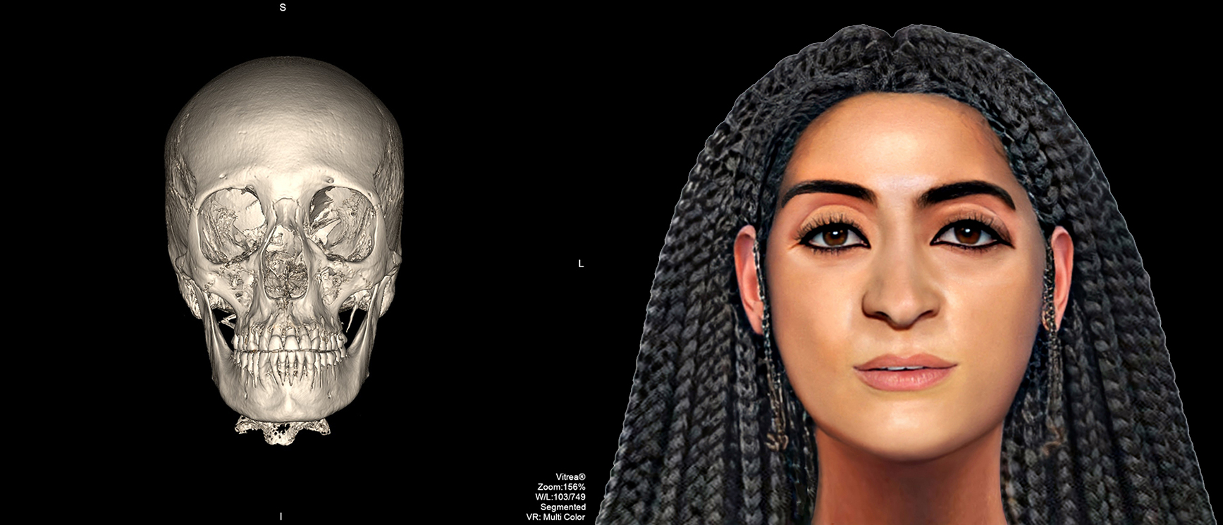 Badania naukowe mumii