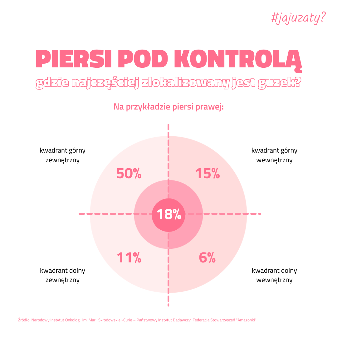 Gdzie najczęściej zlokalizowany jest guzek