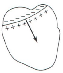 Rysunek przedstawia serce z zaznaczoną falą depolaryzacji (strzałka skierowana z góry serca w dół) przesuwającą się do koniuszka serca oraz wektor elektryczny serca.