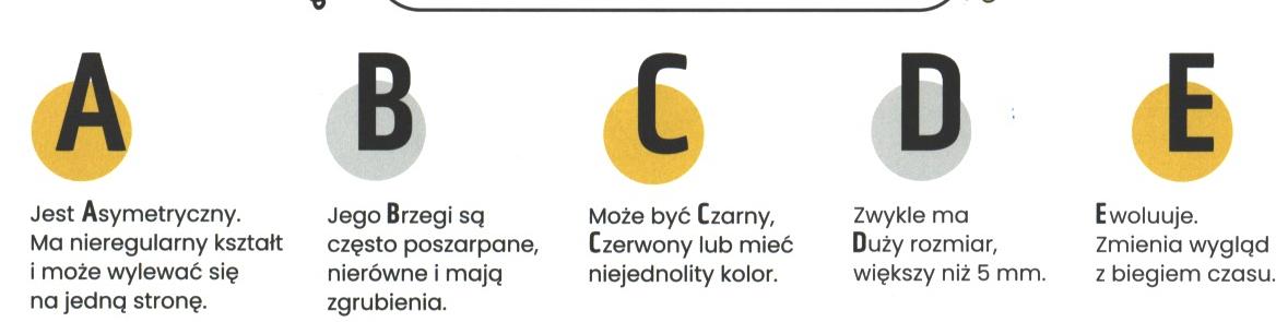 znamię! znam je?, jak rozpoznać czerniaka