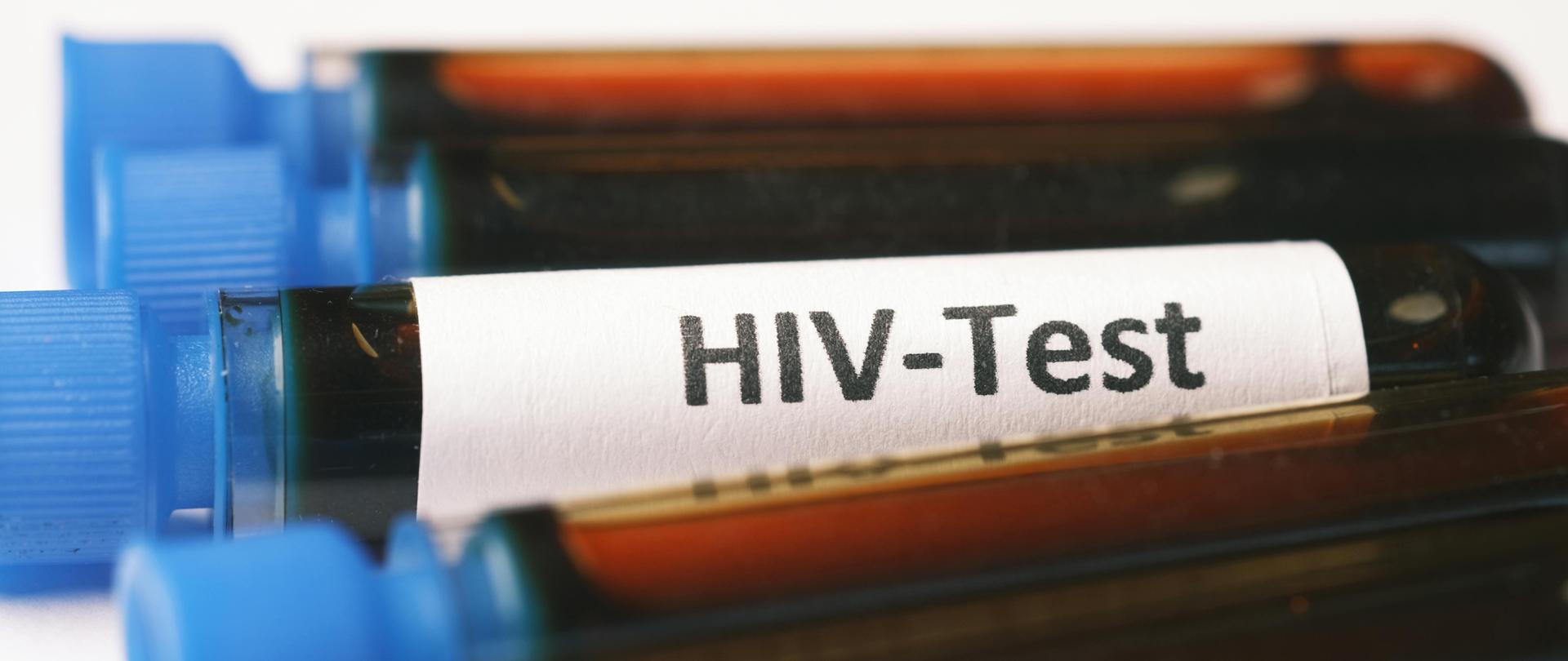 zdjęcie przedstawia ampułki do badań z etykietą z napisem HIV
