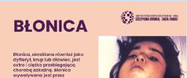 Błonica 