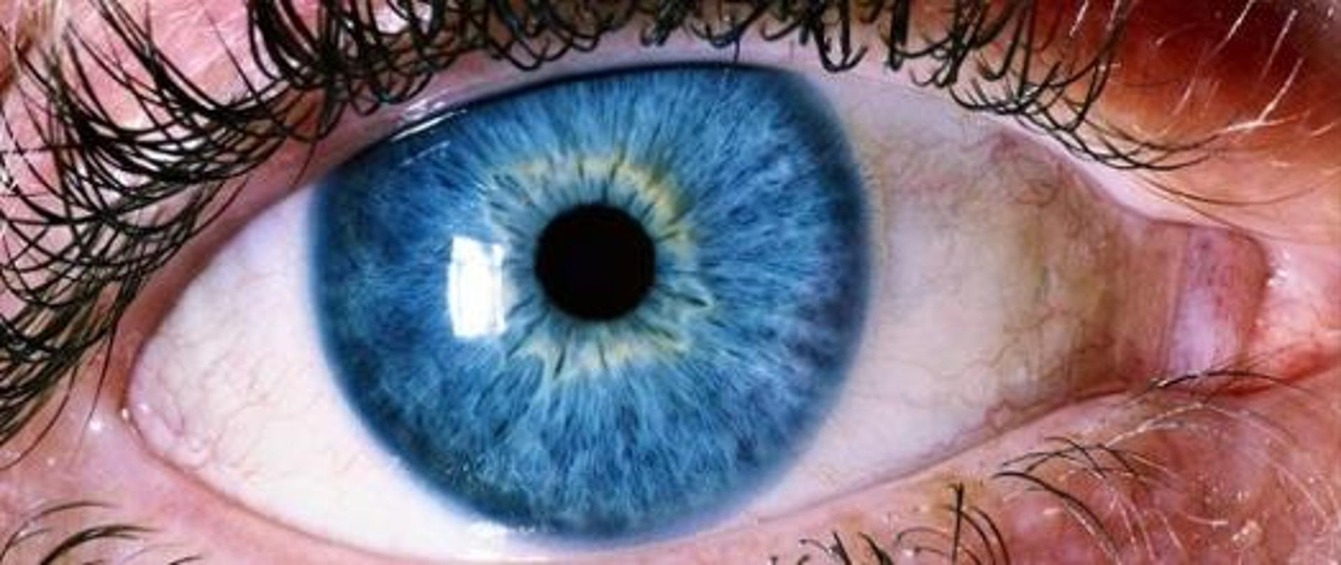 Światowy Dzień Wzroku. Na zdjęciu ukazano oko z niebieską tęczówką. 