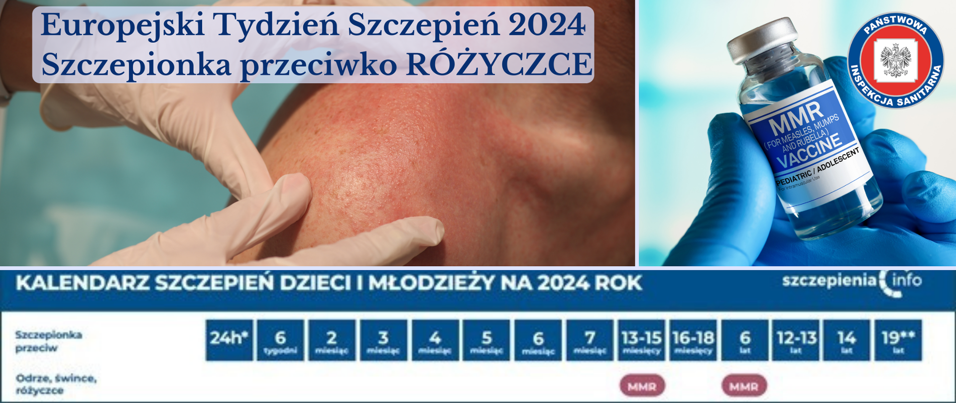 Szczepienie p/ko różyczce