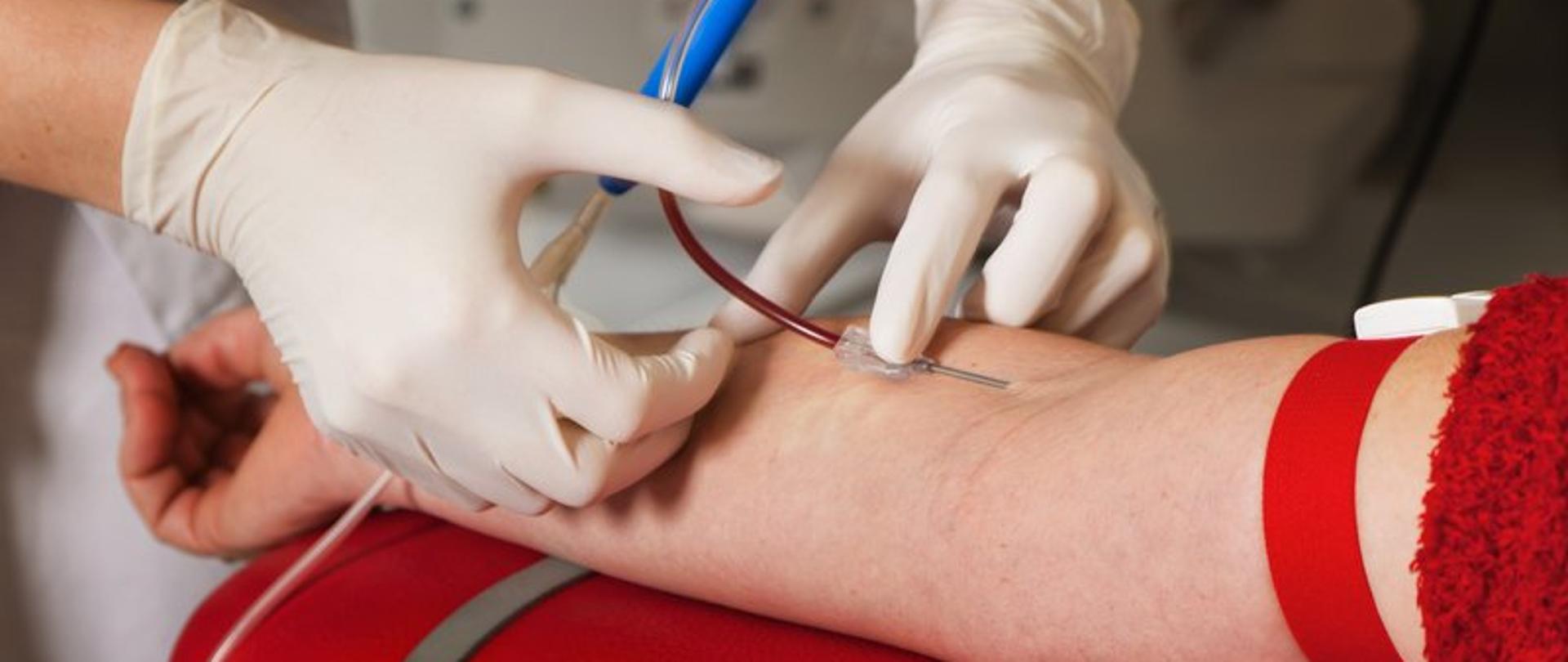 Wkłuwanie igły na przedramieniu w celu pobrania krwi