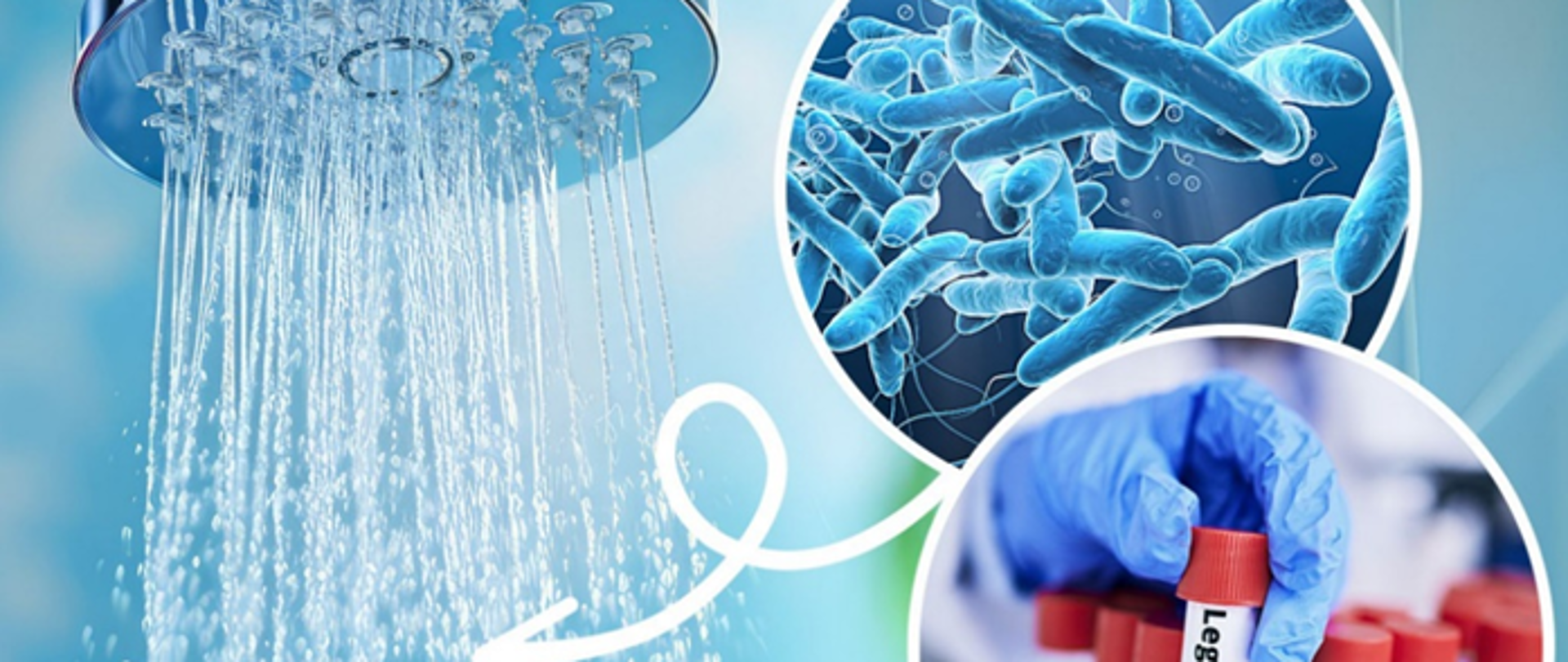 Obrazek przedstawiający pałeczki bakterii Legionella