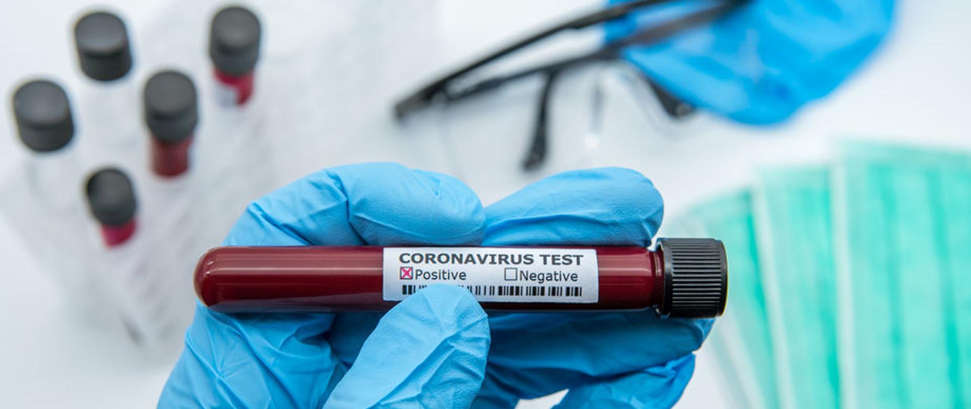 koronawirus, covid-19, test pozytywny