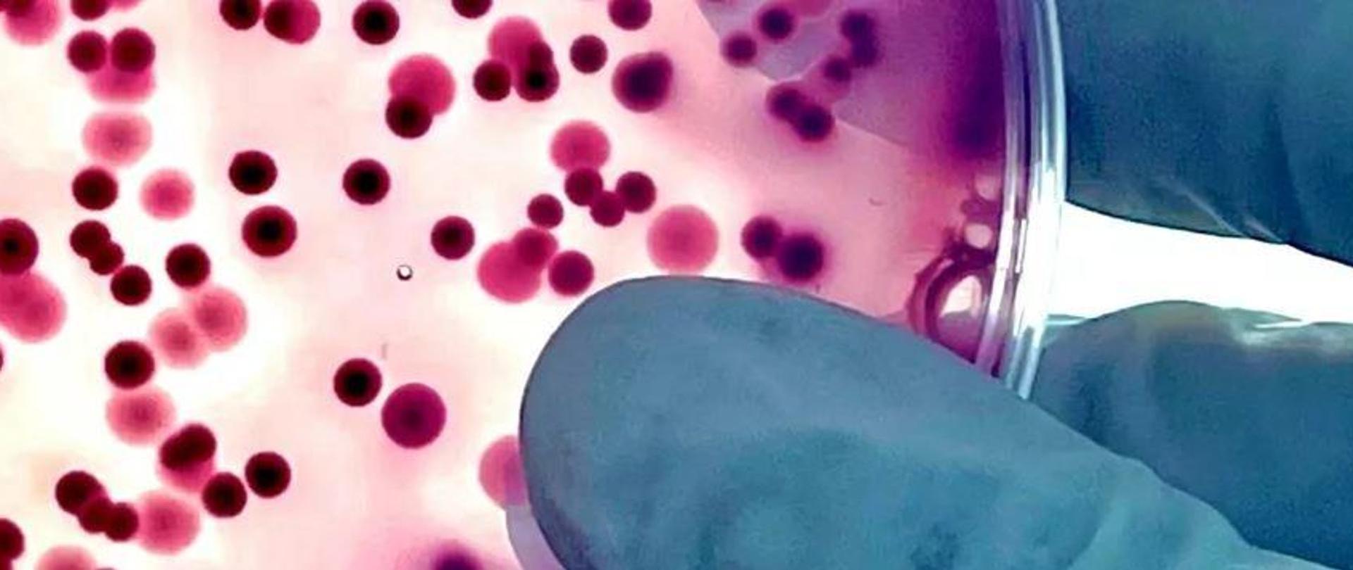 Grafika Choroby przenoszone przez żywność