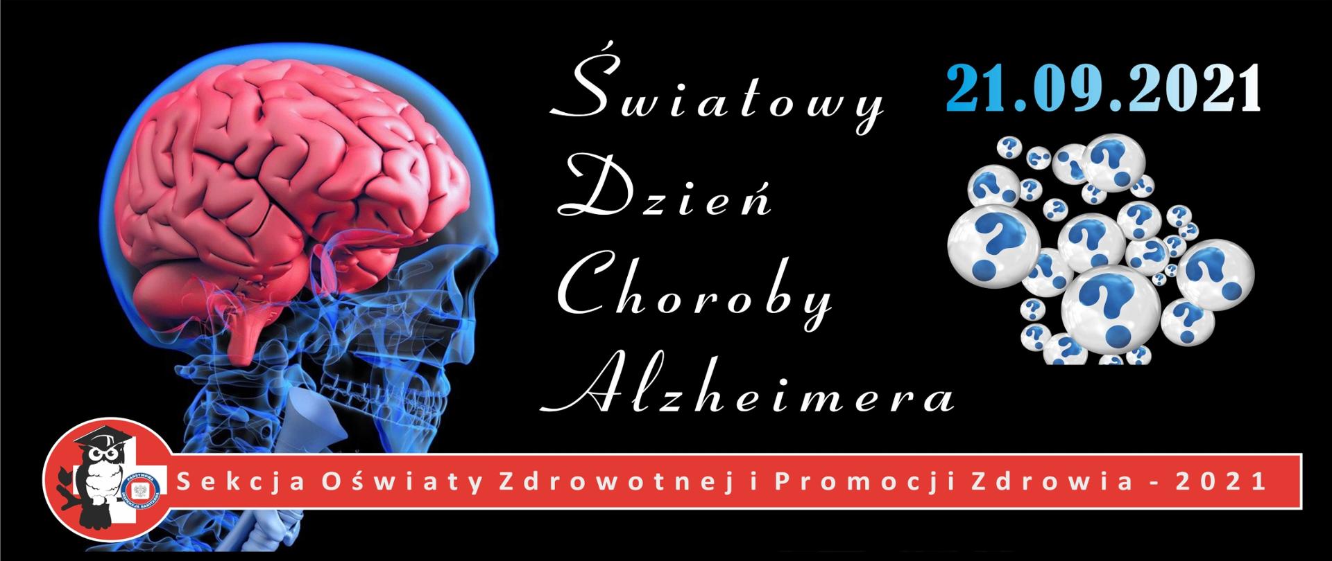 Światowy Dzień Choroby Alzheimera (pixabay.com / Gerd Altmann)