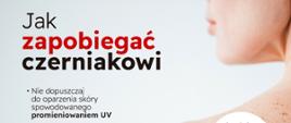 Co trzeba wiedzieć o czerniaku?