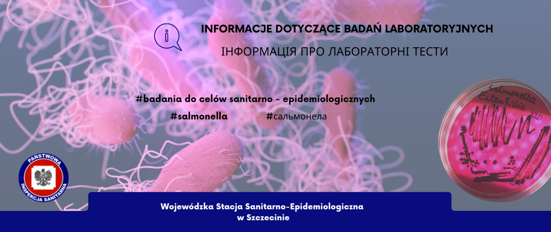 Zdjecie przedstawia paleczki bakterii salmonelli