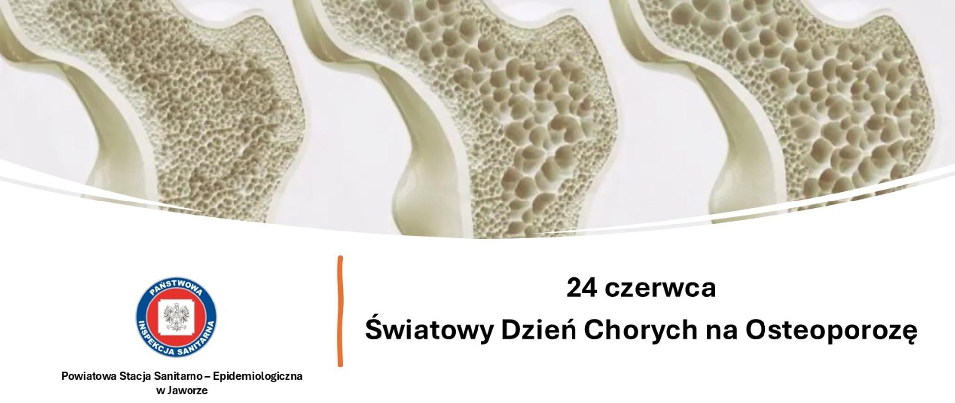 24 czerwca Swiatowy Dzień Chorych na Osteoporozę