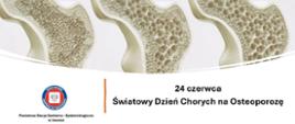 24 czerwca obchodzony jest Światowy Dzień Chorych na Osteoporozę