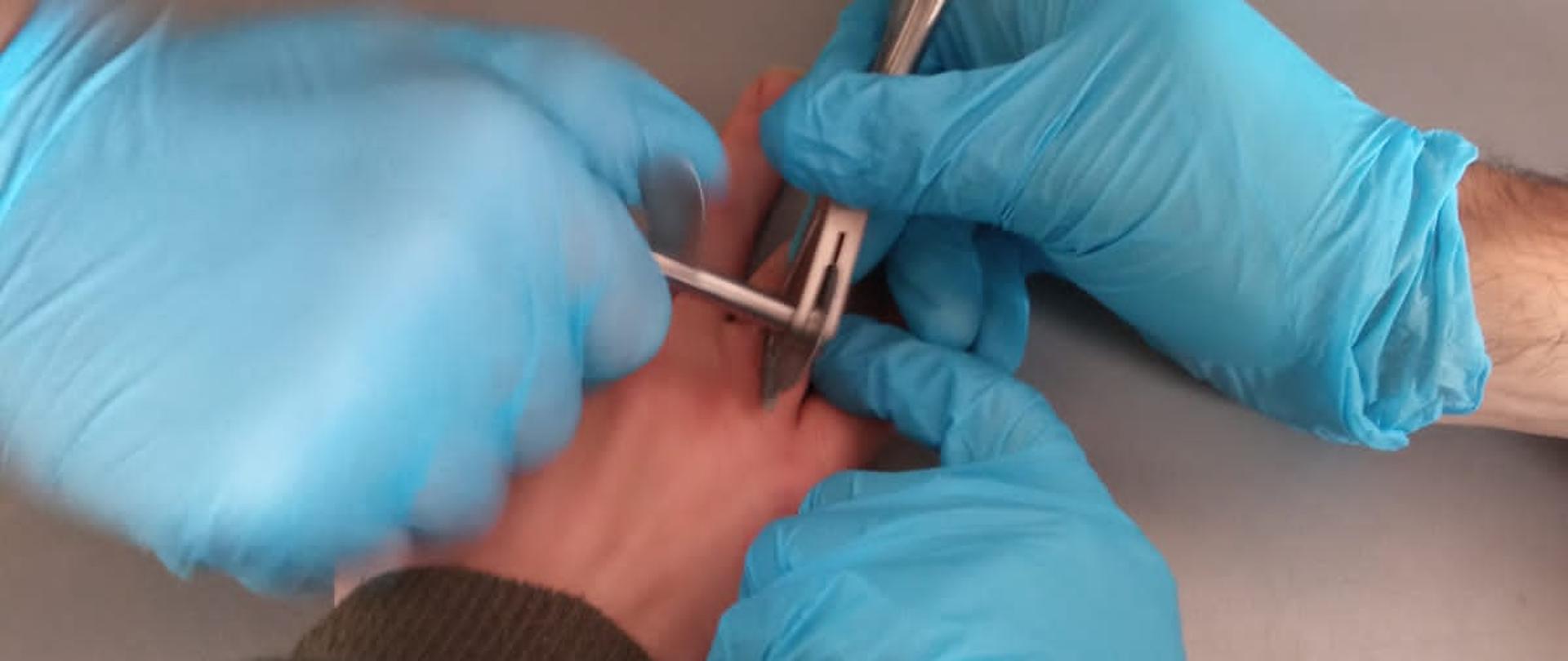 Na zdjęciu strażacy przecinający obrączkę na palcu mężczyzny z pomocą narzędzia do cięcia/ przecinania obrączek/pierścionków