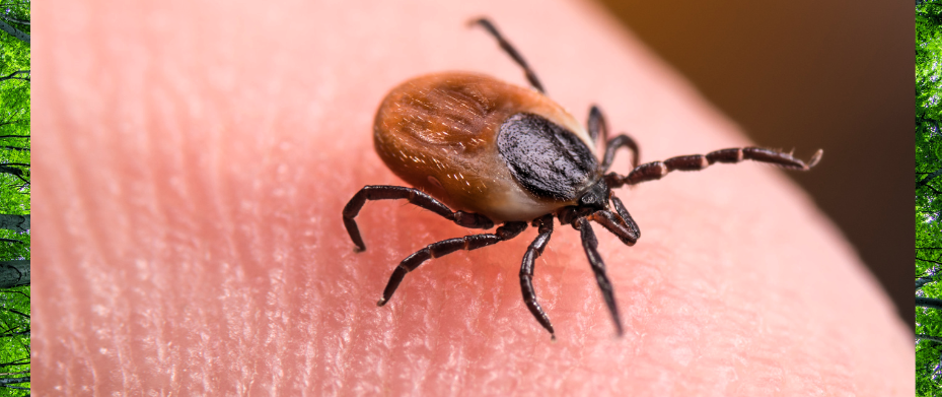 Obraz przedstawia kleszcza znajdujący się na ciele człowieka