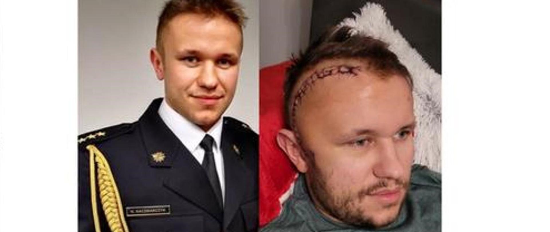 POTRZEBNA POMOC dla strażaka z Komendy Powiatowej PSP w Legionowie!