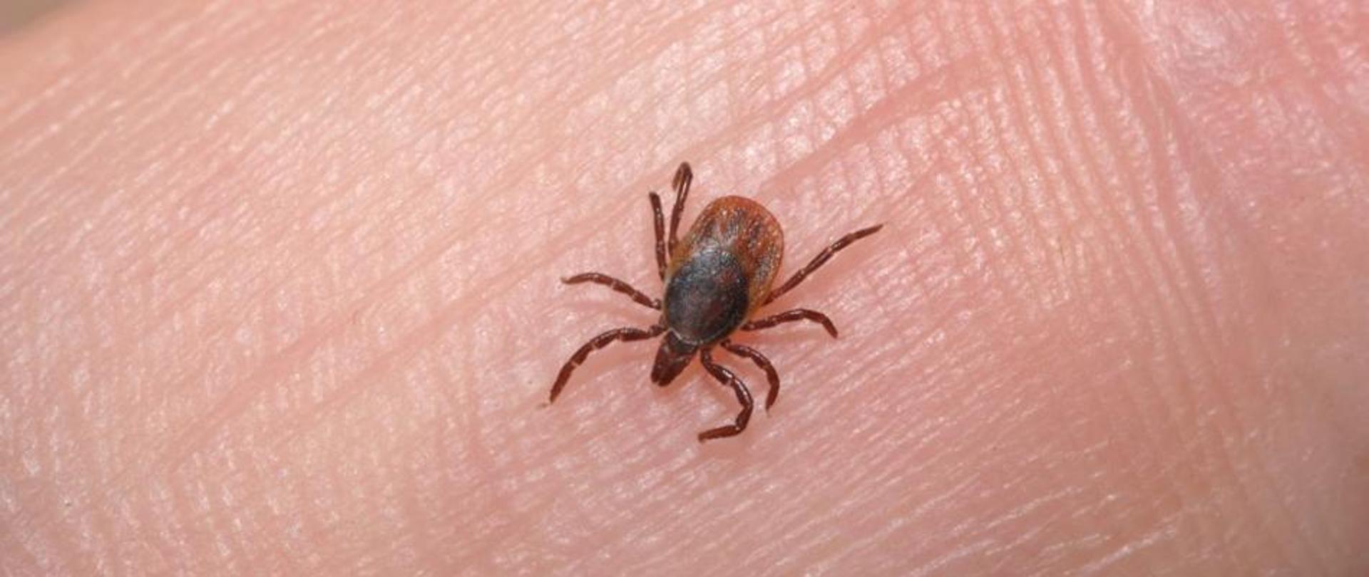 kleszcz na skórze ludzkiej