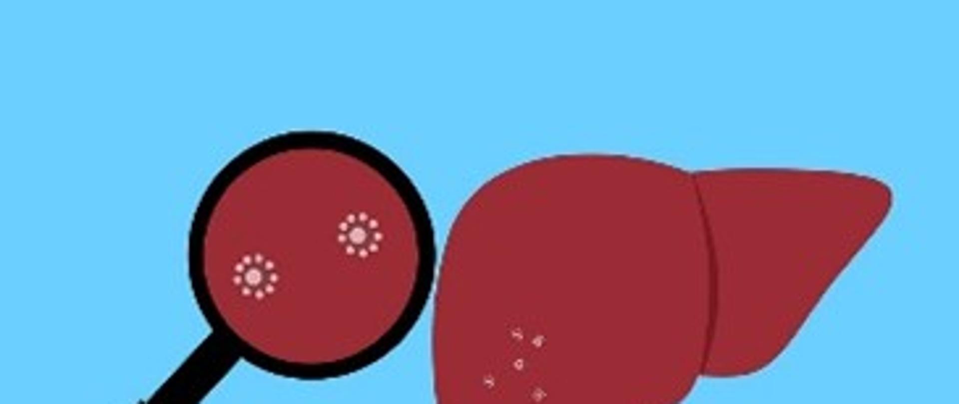 Światowy Dzień Wirusowego Zapalenia Wątroby