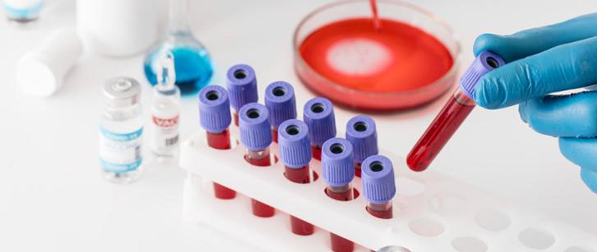 Fiolki z krwią. Jedną z fiolek trzyma ręka w rękawiczce ochronnej.