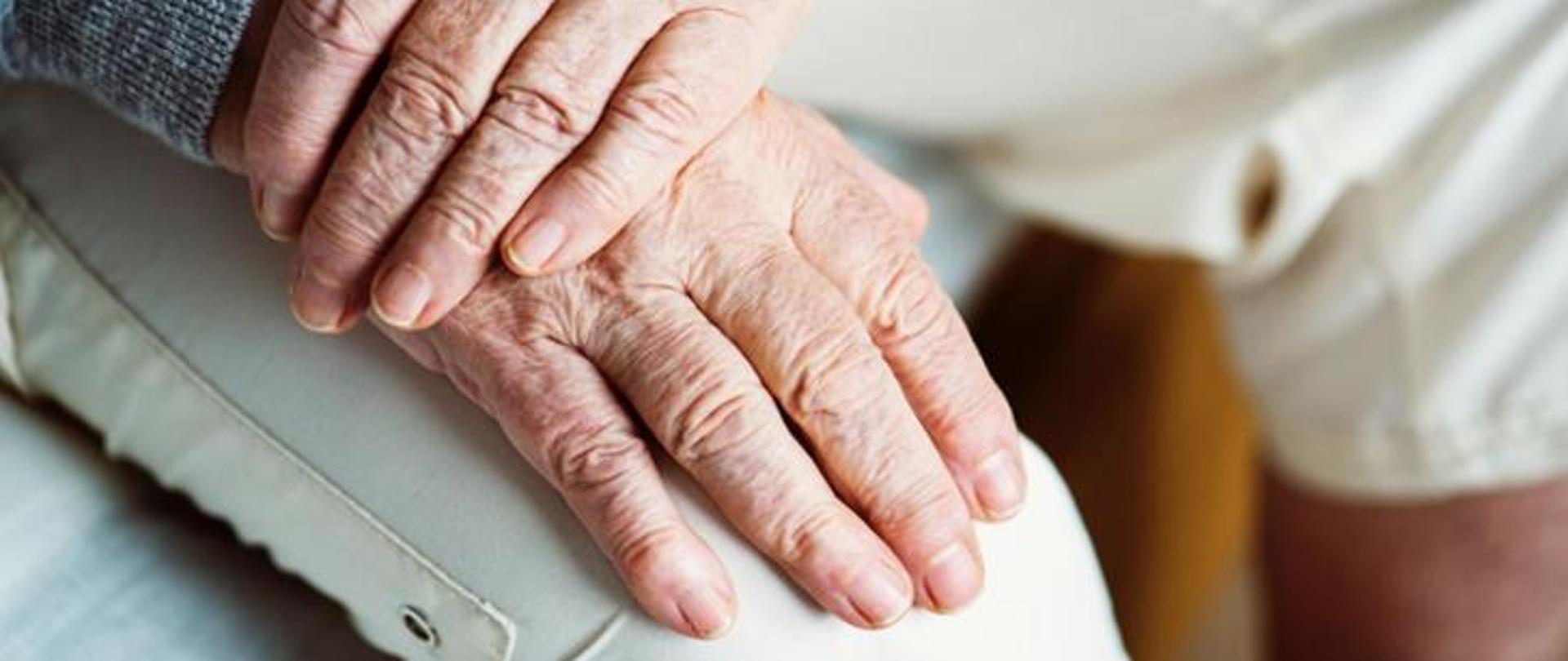 Zdjęcie poglądowe: dłonie starszej osoby