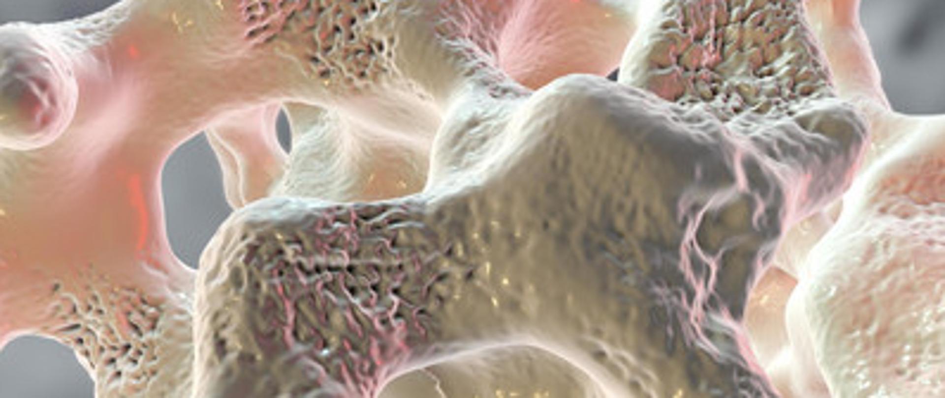 20 października - Światowy Dzień Osteoporozy