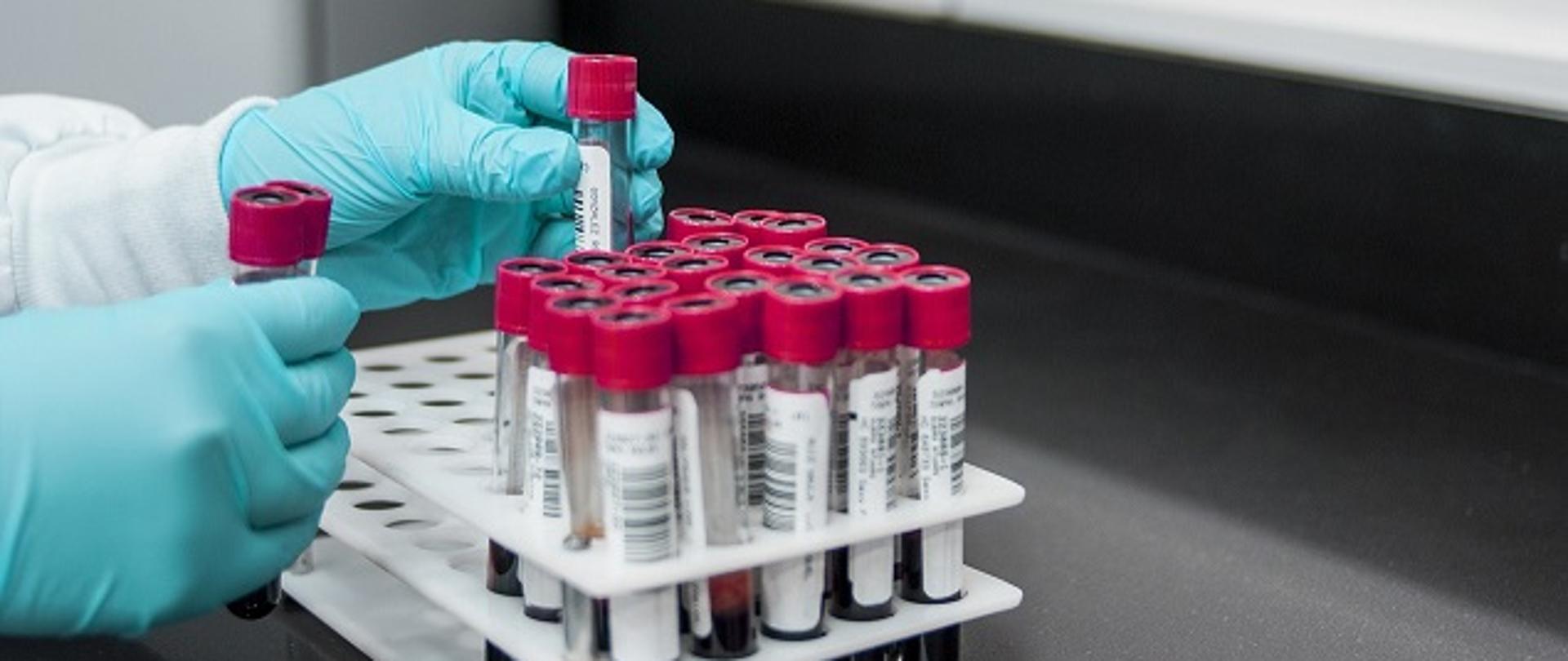 probówki z krwią w stojaku w laboratorium