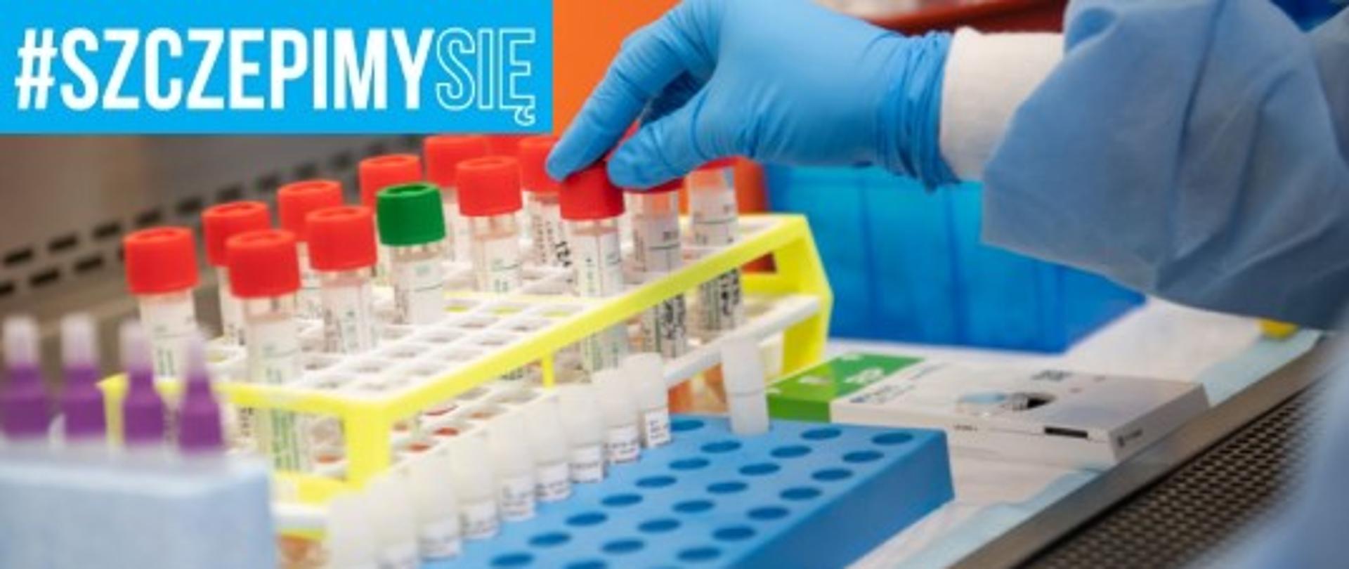 Czy należy wykonać test serologiczny?