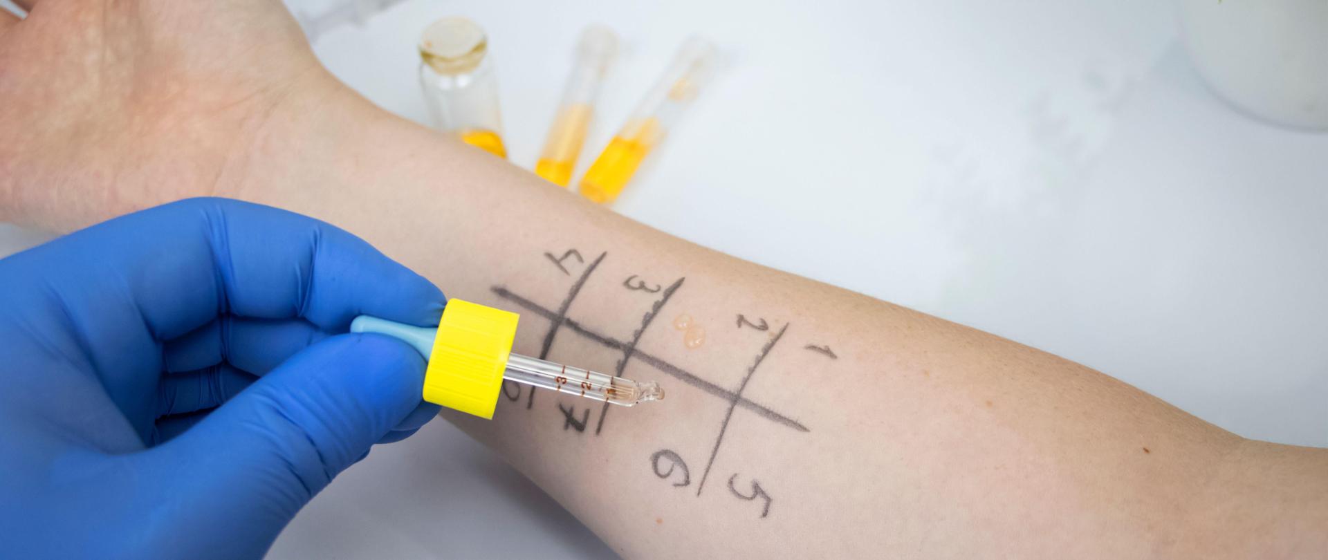 ŚWIATOWY TYDZIEŃ ALERGII