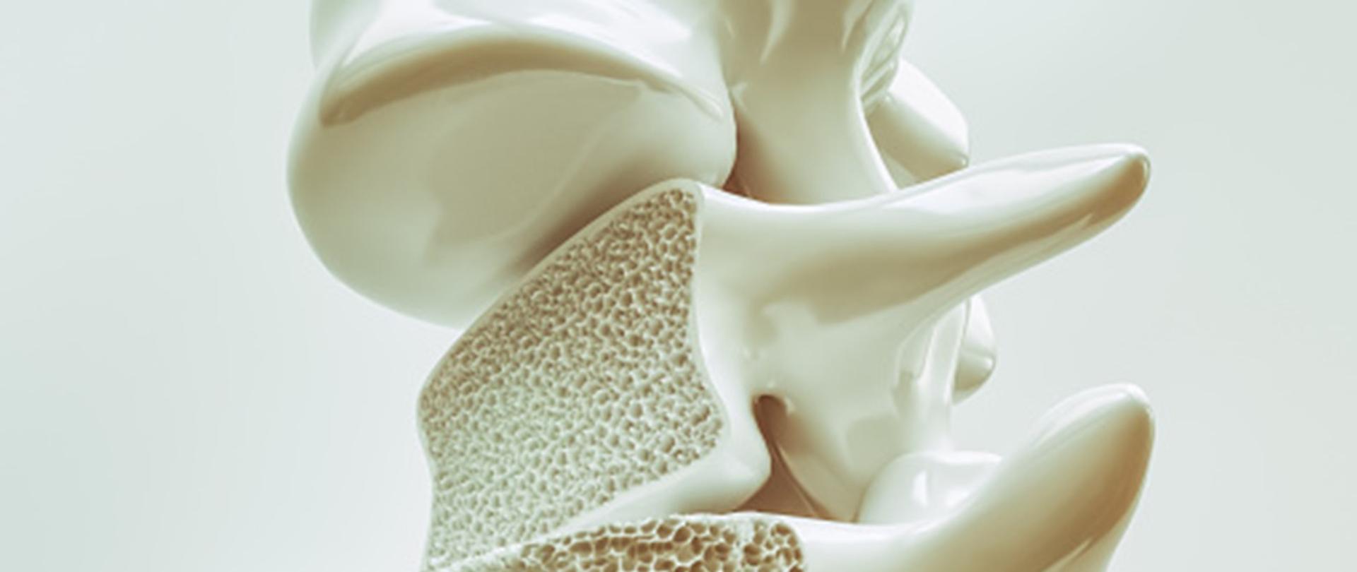 Światowy Dzień Chorych na Osteoporozę 