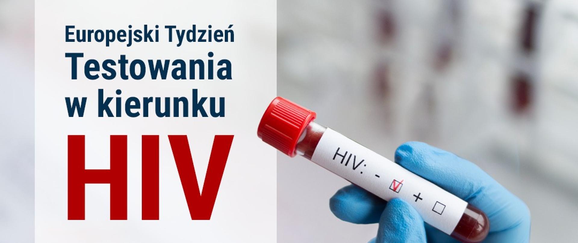 21-28 listopada Europejski Tydzień Testowania w kierunku HIV 