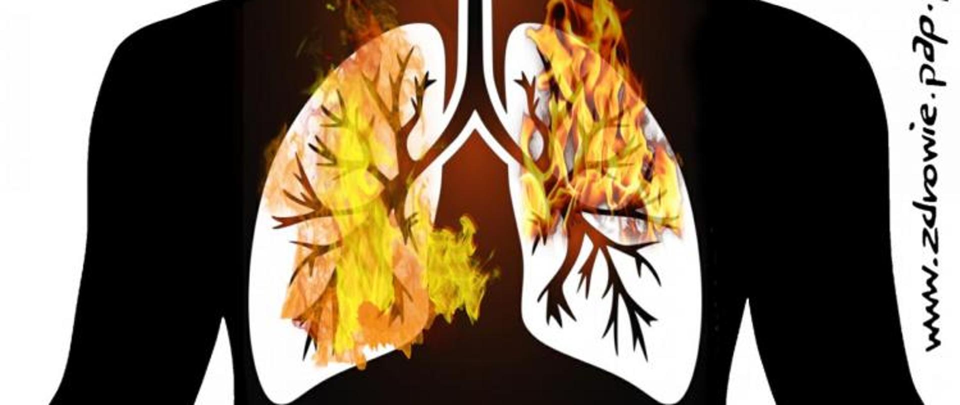 Zanieczyszczenie_powietrza_bardziej_szkodliwe_niż_wcześniej_sądzono