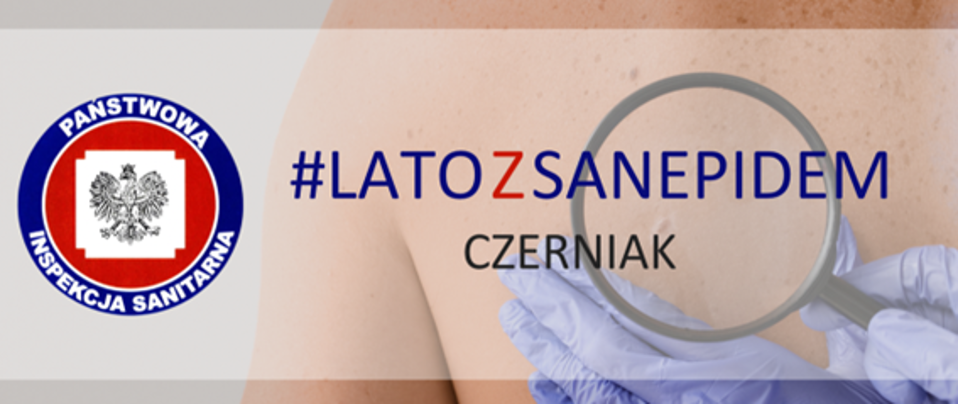 Grafika przedstawia mężczyznę odwróconych plecami z zaznaczonymi wokół znamionami, oraz dłonie trzymające lupę przeprowadzając diagnostykę. Na obrazku napis: #latozsanepidem CZERNIAK