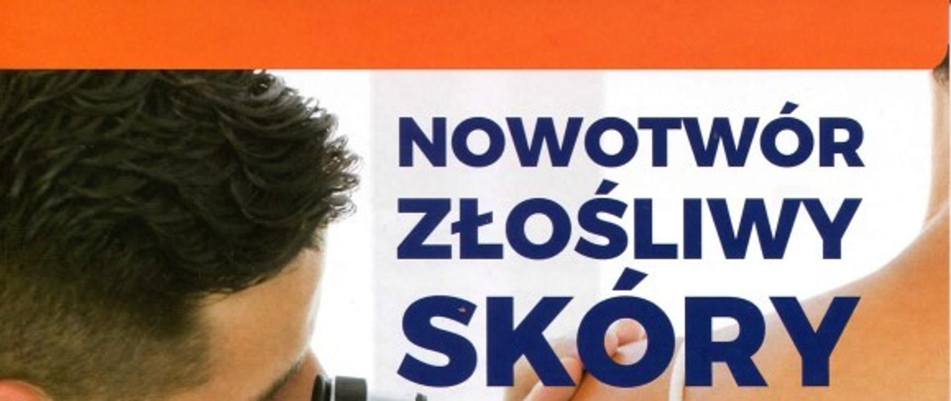 Nowotwór_skóry