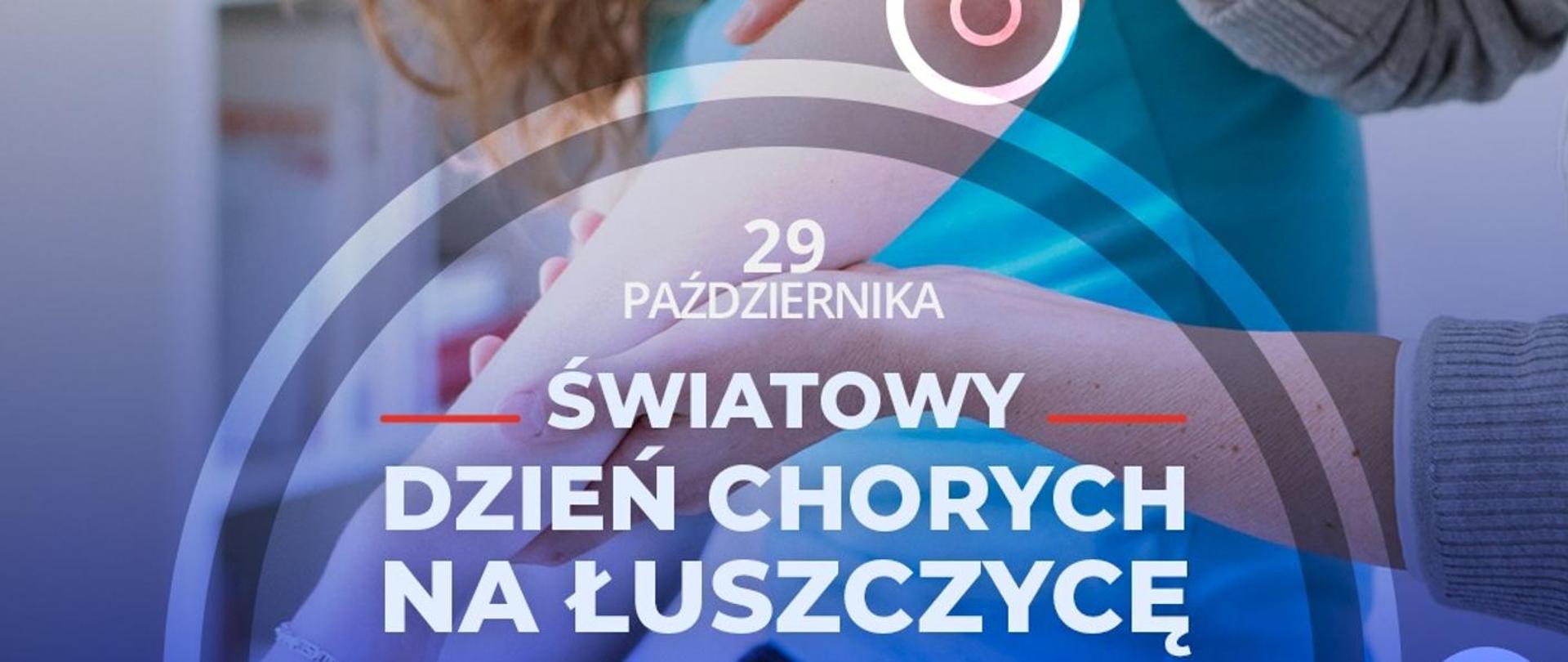 Kobieta prezentuje łokieć ze zmianami skórnymi innej osobie.