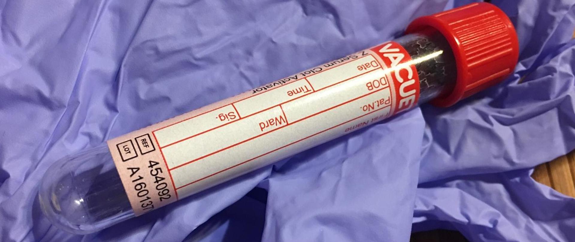 Zdjęcie przedstawia plastikową fiolkę z czerwoną zakrętką . Próbówka ułożona jest na niebieskiej rękawicy.