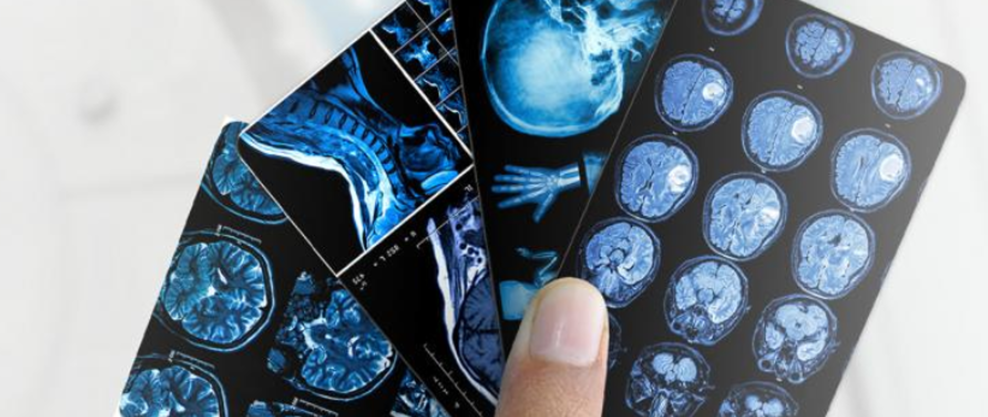 Baner promujący IX Europejski Tydzień Profilaktyki Nowotworów Głowy i Szyi