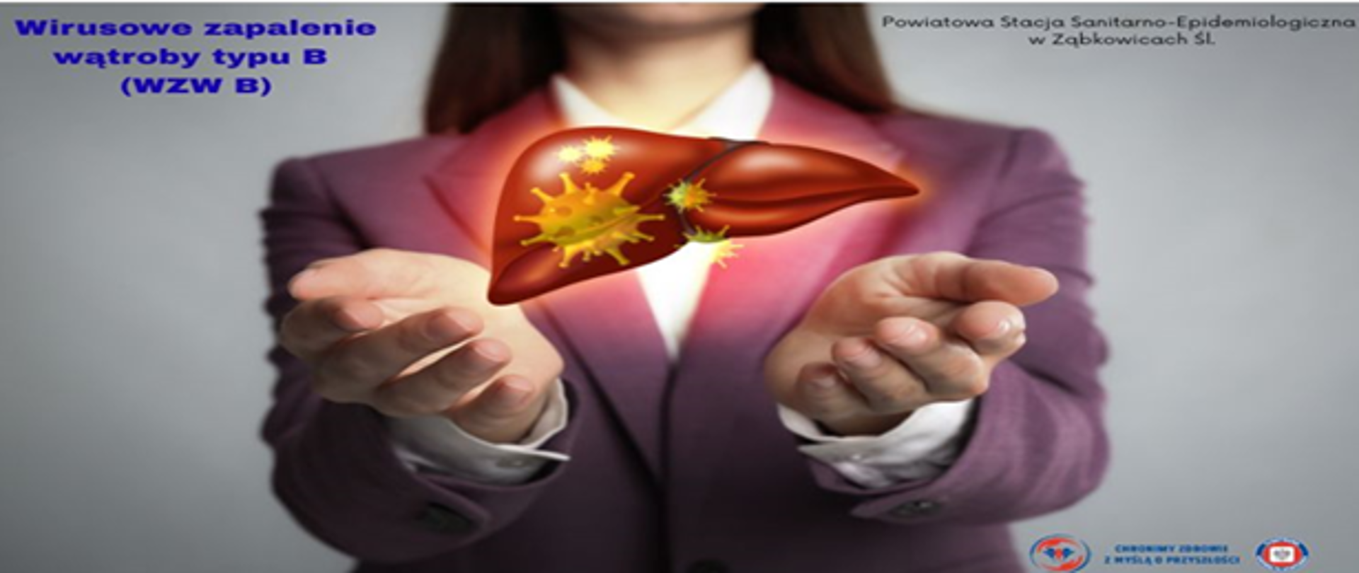 Wirusowe zapalenie wątroby thumbnail 