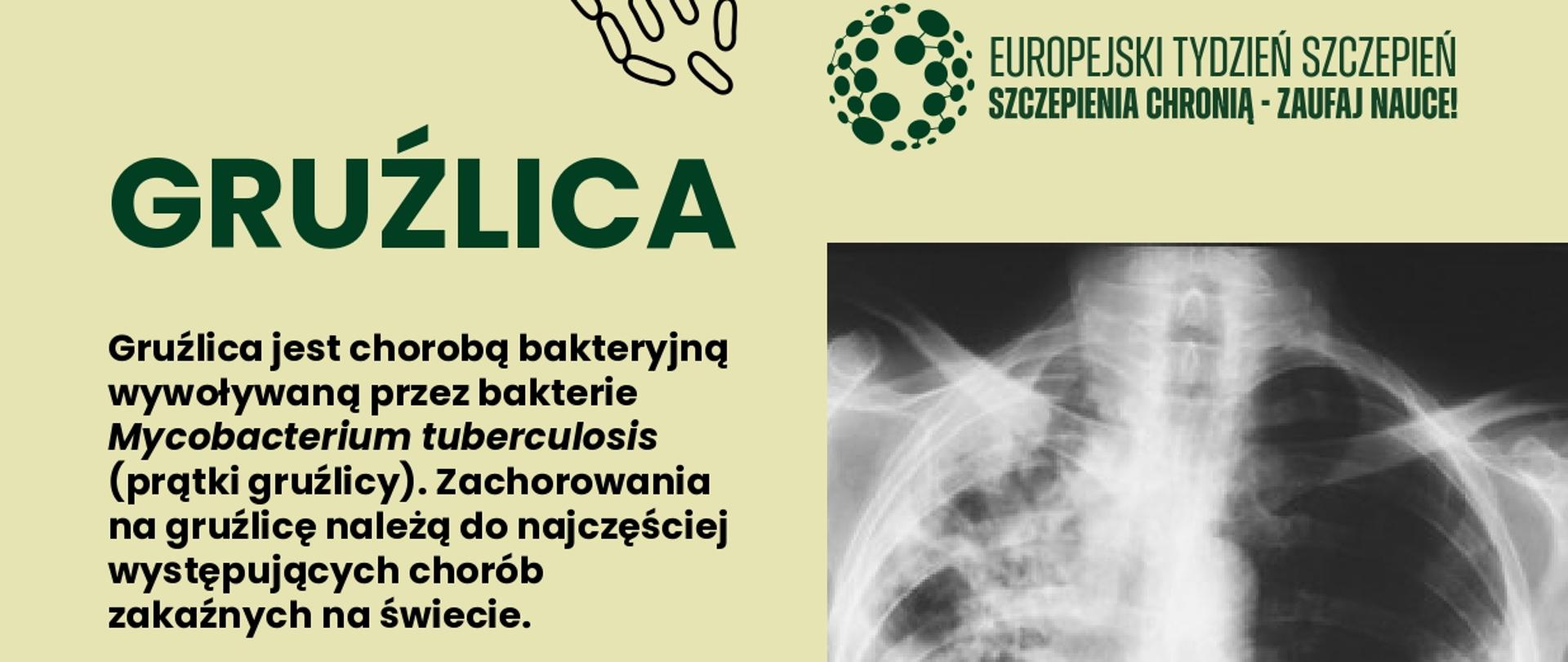 grużlica_baner