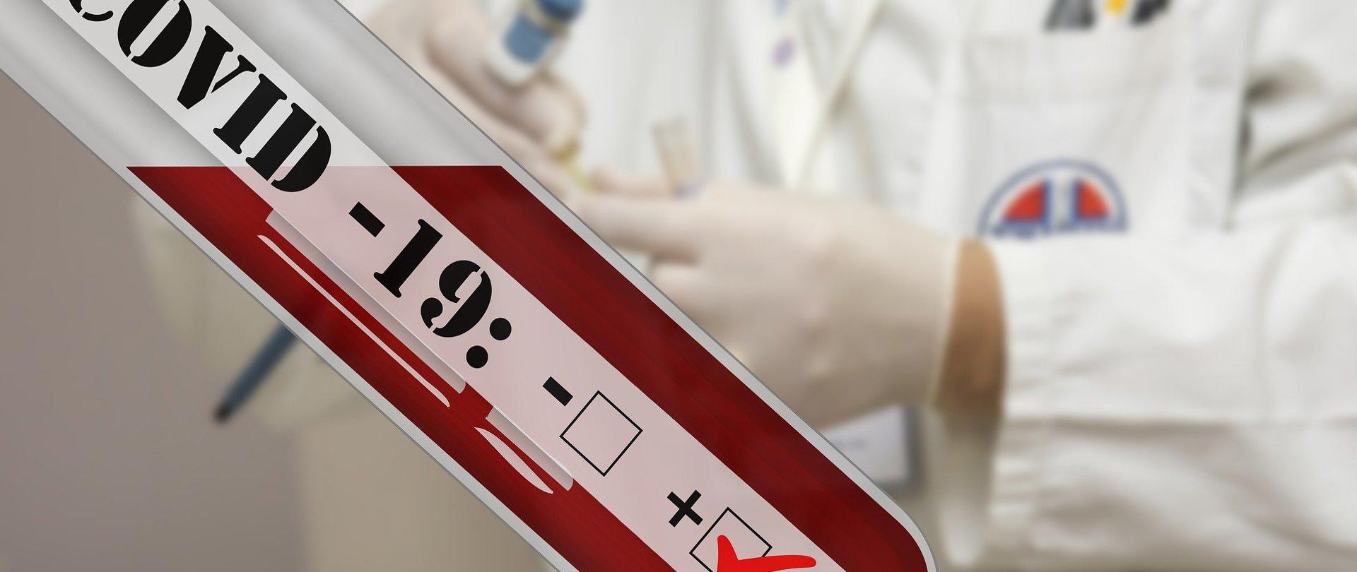 grafika z fiolką laboratoryjną, na której jest zaznaczony pozytywny wynik Covid-19
