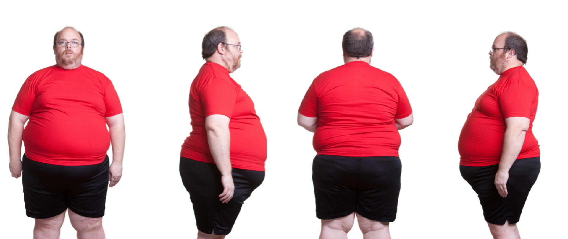 Zdjęcie przedstawia otyłego mężczyznę z przodu, od tyłu i z boku. Ubrany jest w obcisły czerwony podkoszulek i czarne spodenki.