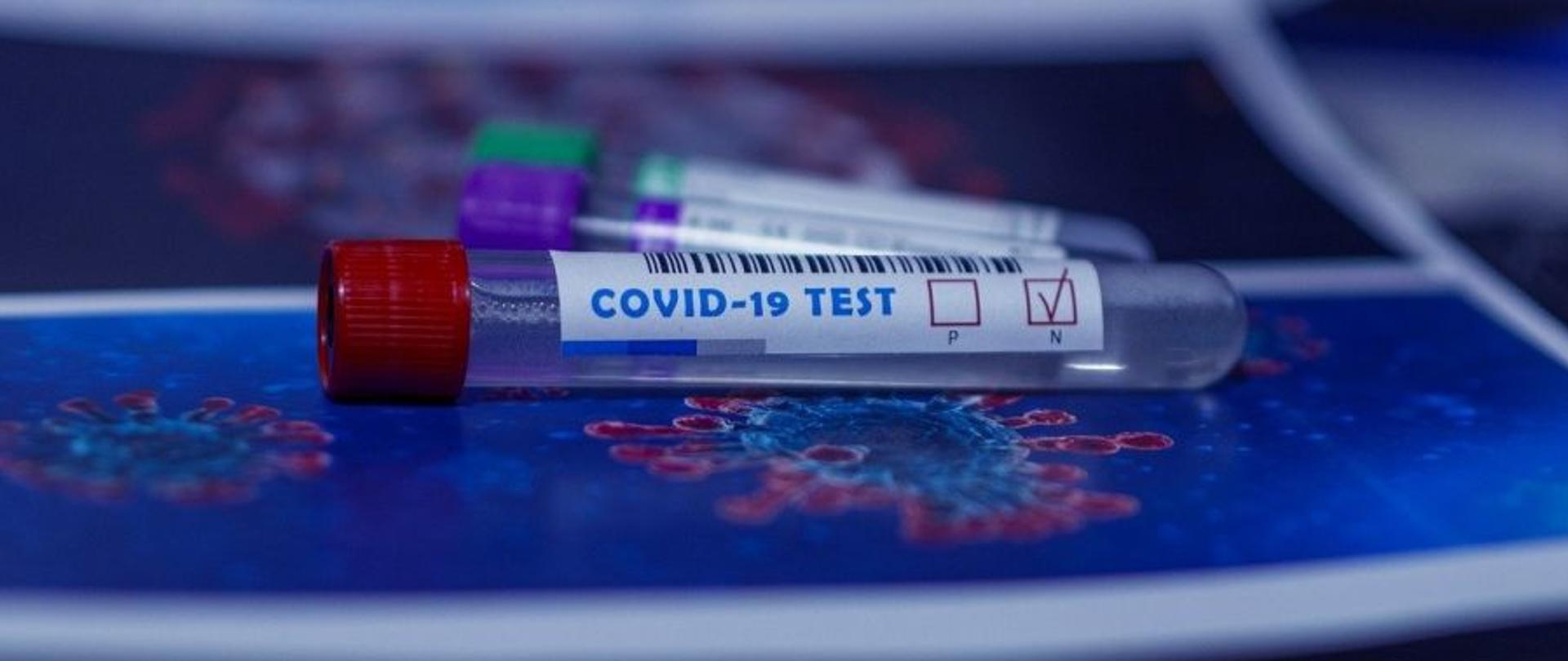 Fiolka do badań wymazów na obecność wirusa Covid-19