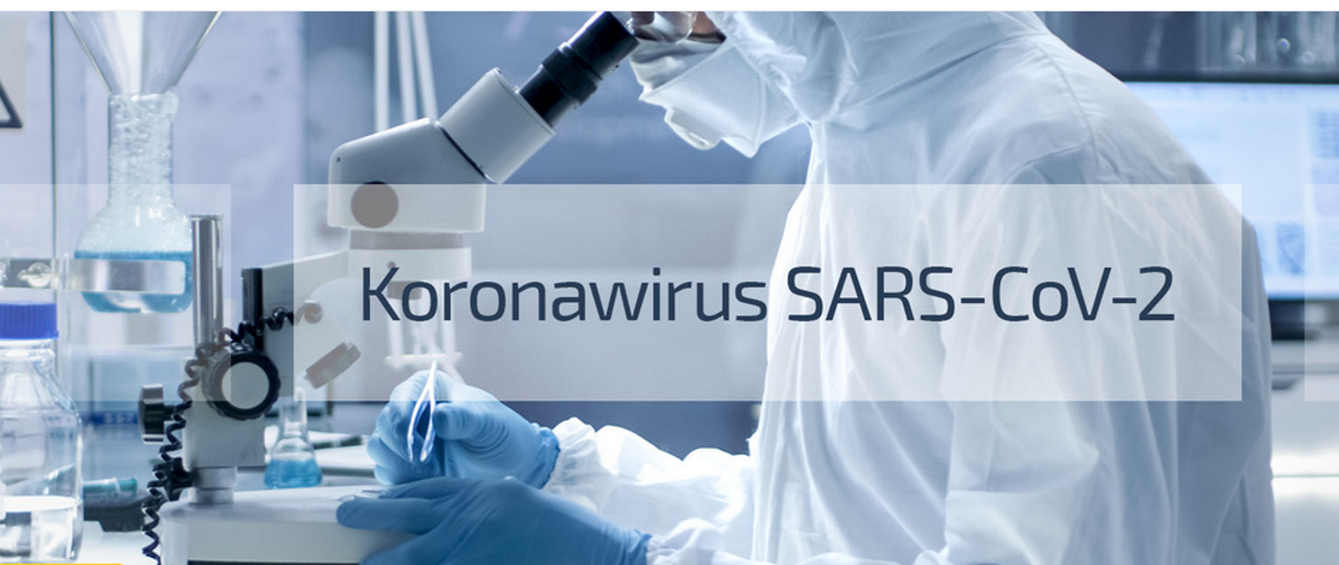 Opinia na temat testów serologicznych anty SARS-CoV-2