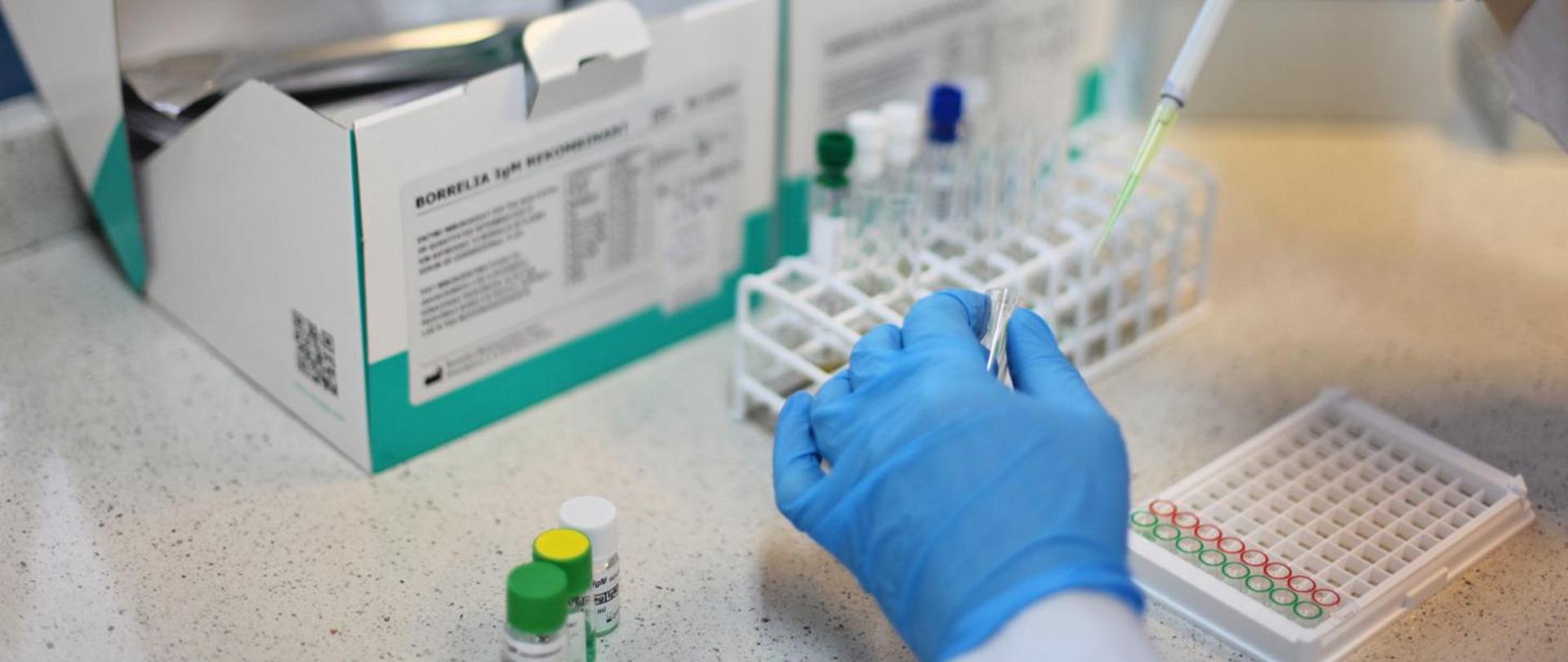 zdjęcie dotyczące kampanii w sprawie kleszcze, na zdjęciu badanie w kierunku boreliozy