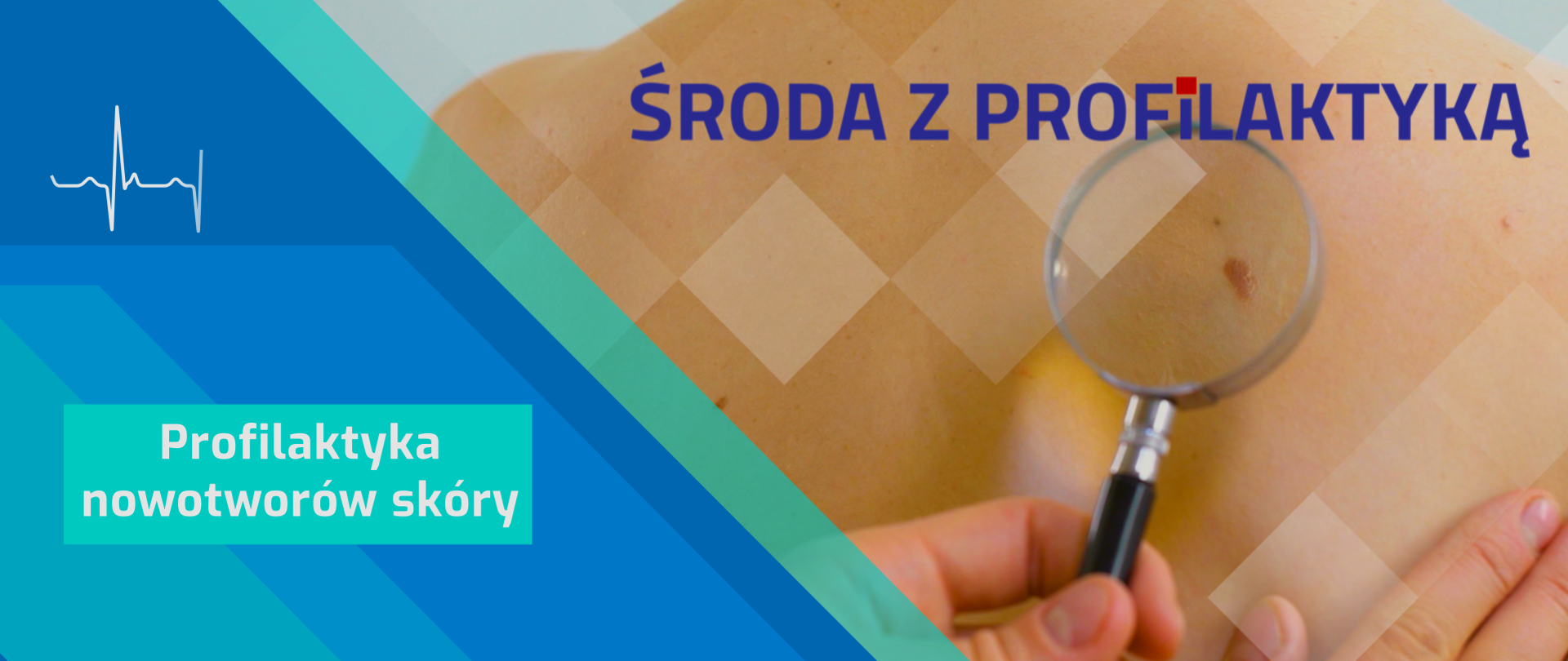 Profilaktyka nowotworów skóry