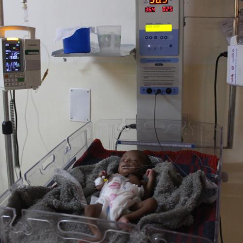 Niemowlę leży podpięte do sprzętu medycznego w za dużej pieluszce, na kocyku