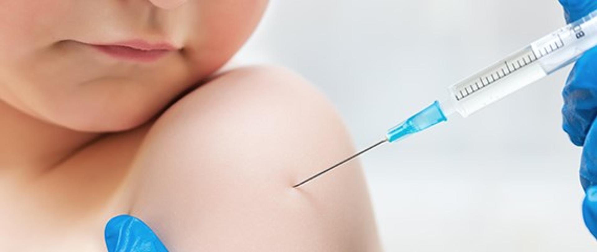 Na obrazku widoczne jest dziecko (ramie i część twarzy- broda i usta) podczas szczepienia. Pielęgniarka w niebieskich rękawiczkach Widoczne tylko dłonie) wstrzykująca szczepionkę.