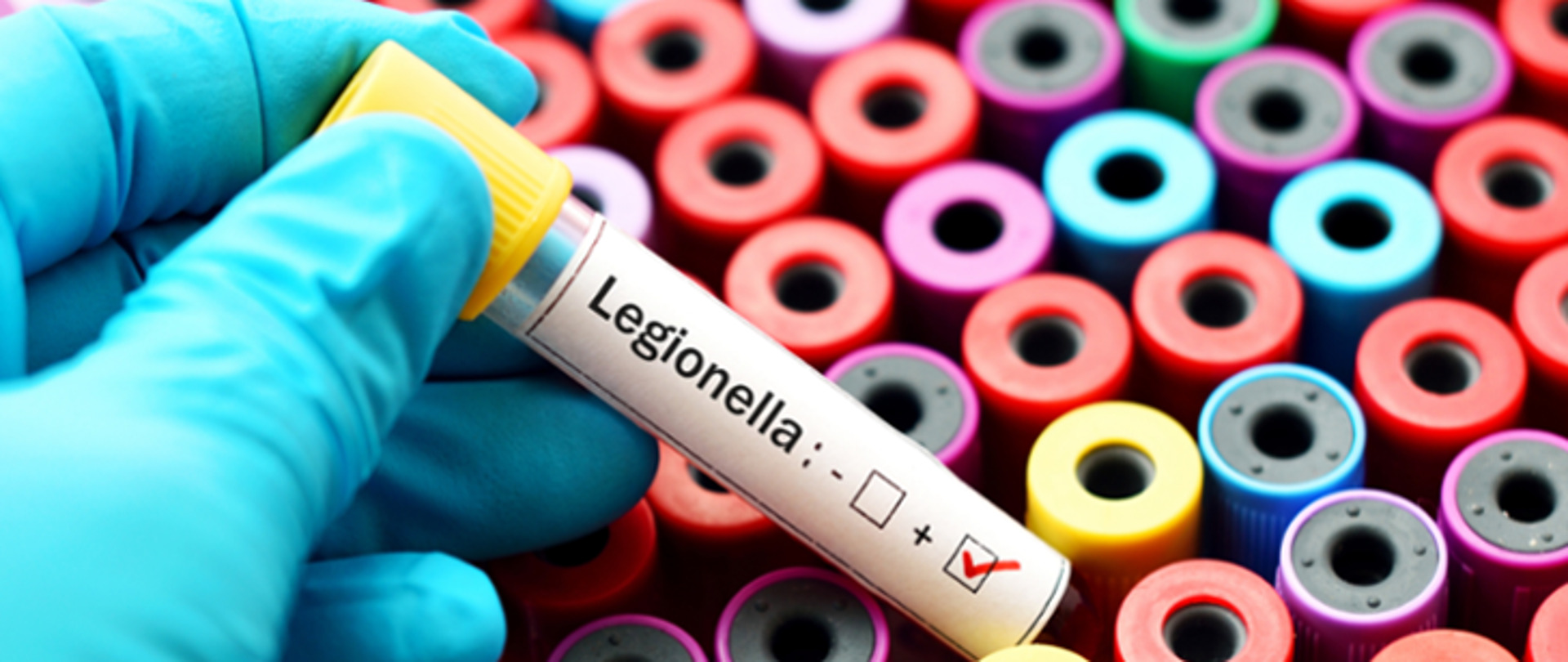 Legionella