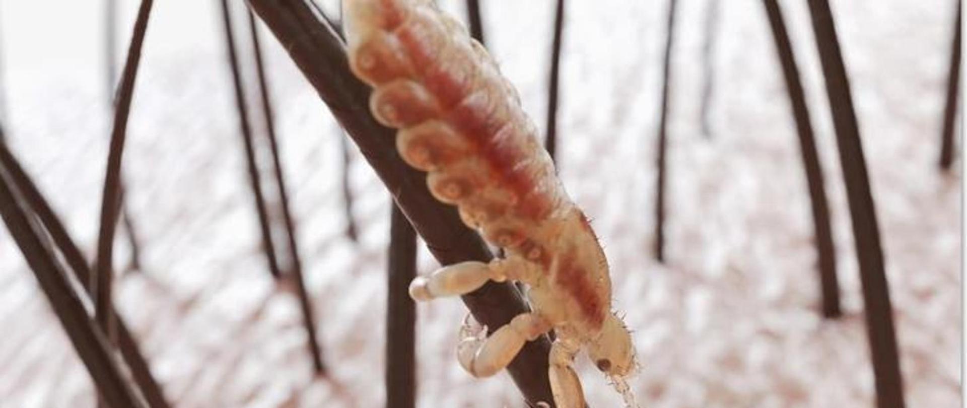 Zdjęcie przedstawia wesz na włosach